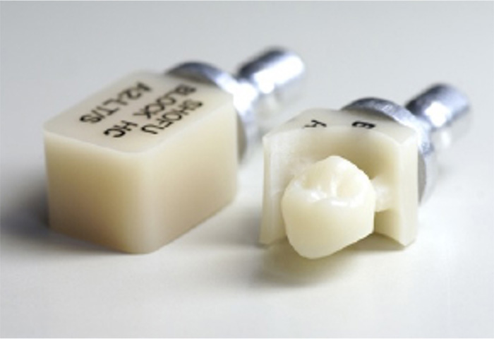 札幌市白石区の歯医者、オーブデンタルクリニックで、保険治療でも白い歯に
